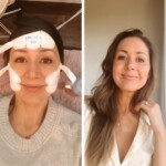 Emface review-before and after