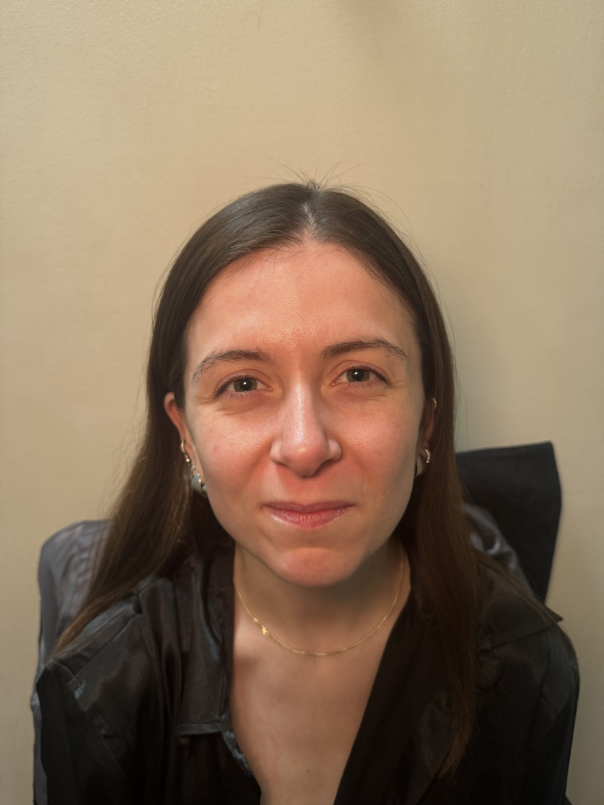 Isabelle Eyman botox in your 20s - before.